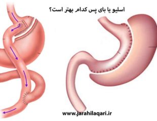 اسلیو یا بای پس