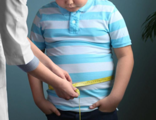 چاقی در کودکان
