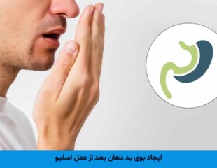 بوی بد دهان بعد از عمل اسلیو