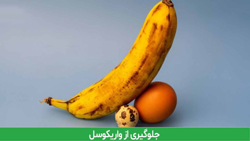 جلوگیری از واریکوسل