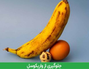 جلوگیری از واریکوسل