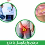 درمان واریکوسل با دارو