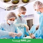 عمل RIRS چیست؟