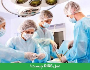 عمل RIRS چیست؟