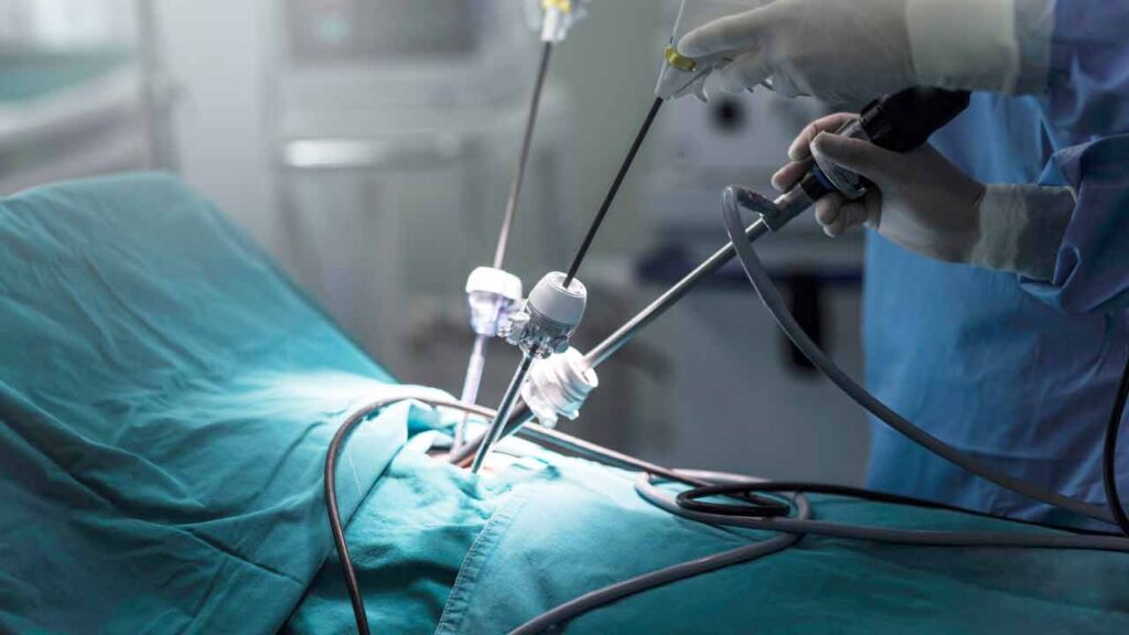 جراحی باز سنگ کلیه چیست؟