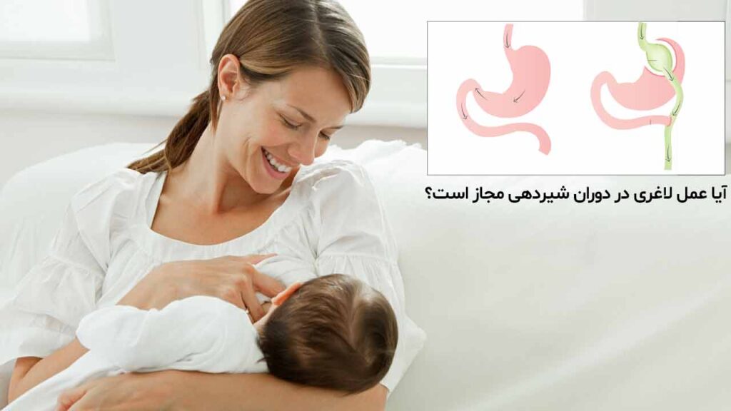 آیا عمل لاغری در دوران شیردهی مجاز است؟