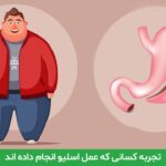 تجربه کسانی که عمل اسلیو انجام داده اند