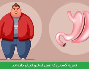 تجربه کسانی که عمل اسلیو انجام داده اند