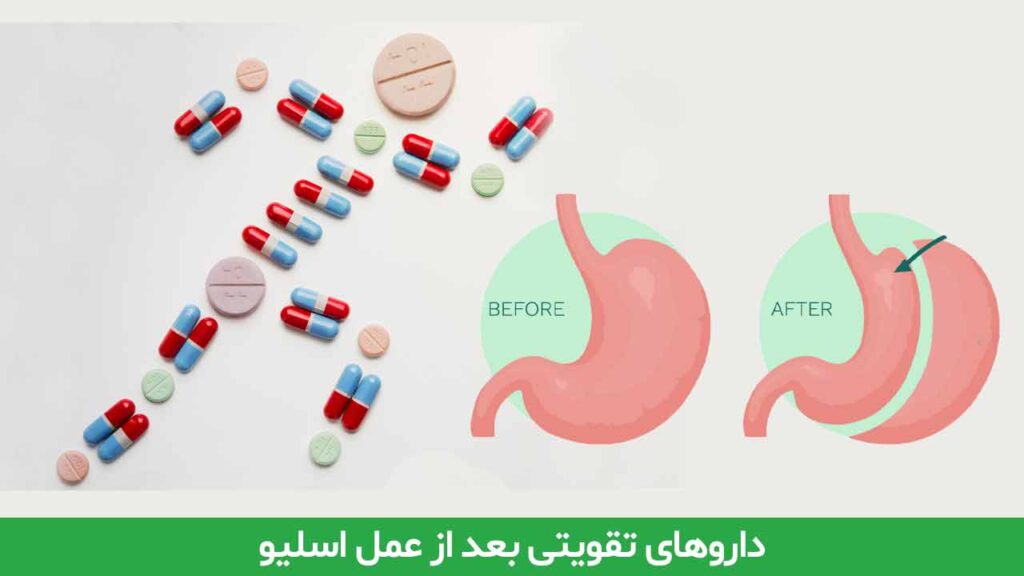 داروهای تقویتی بعد از عمل اسلیو