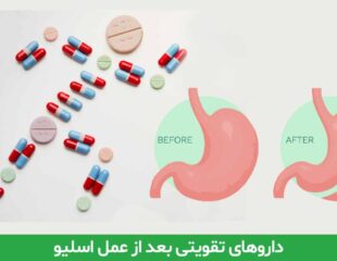 داروهای تقویتی بعد از عمل اسلیو