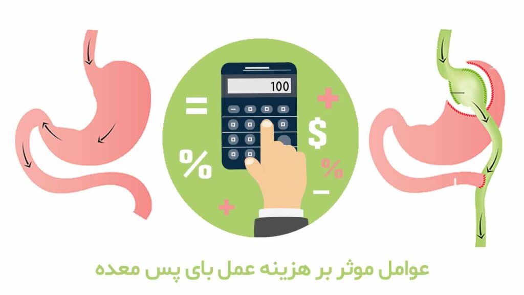 عوامل موثر بر هزینه عمل بای پس معده