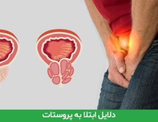 دلایل ابتلا به پروستات