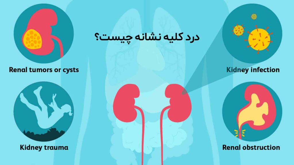 درد کلیه نشانه چیست؟